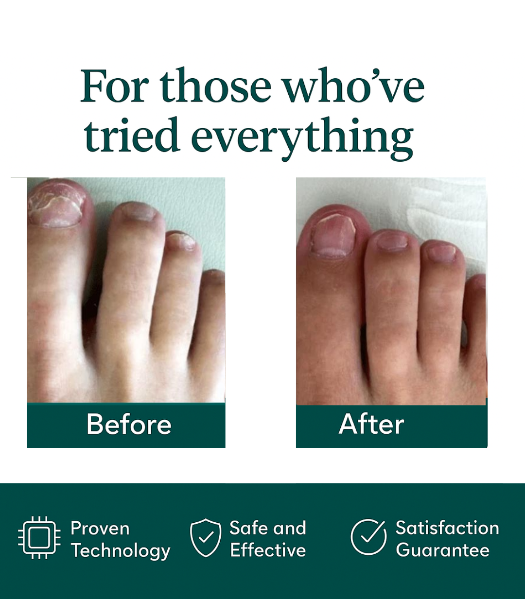 Nail Care Laser Therapy Device (+FREE Glass File + Personal Health Consulting)